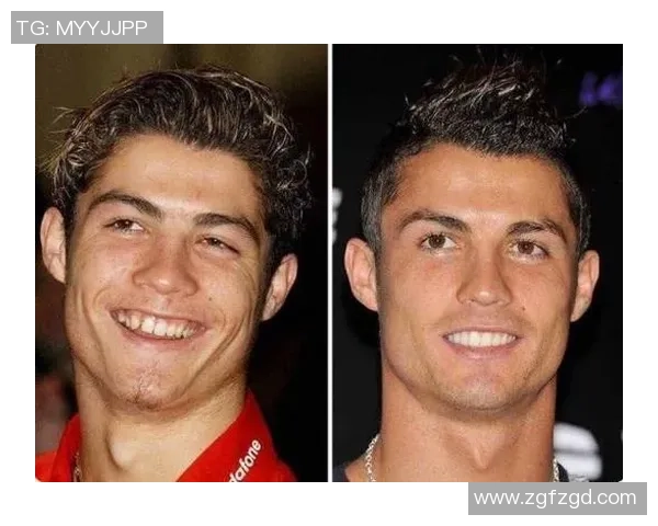 足球明星整容真相揭秘及前后对比图片大曝光